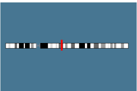 Gène HMGA2 sur le chromosome 12