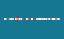 Gène MAGEL2 sur le chromosome 15