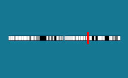 Gène PAPP-A2 sur le chromosome 1